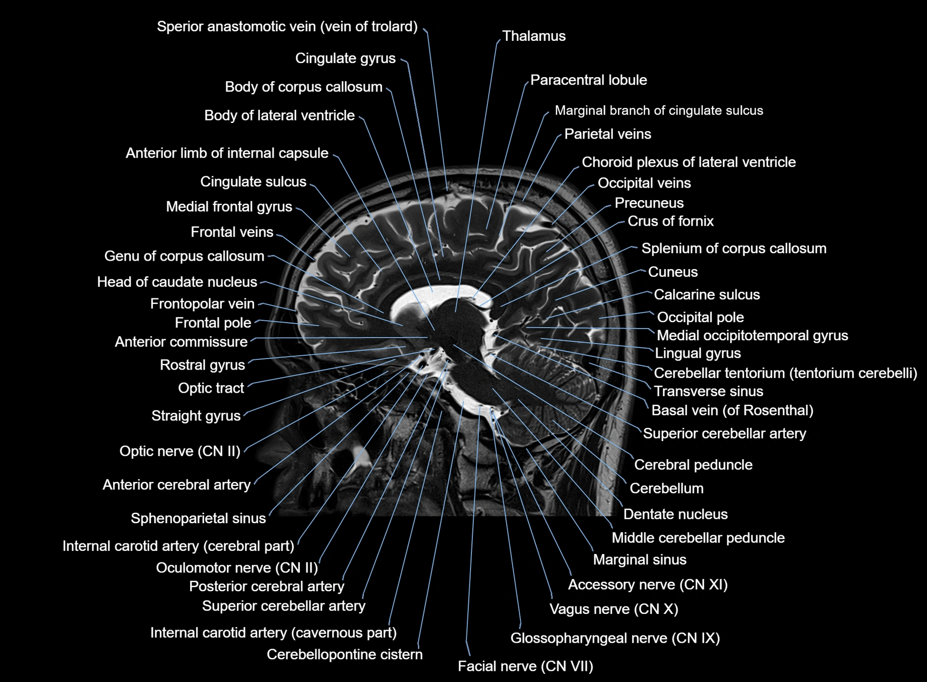 brain sagittal anatomy 3T MRI images -img-00001-00029.webp
